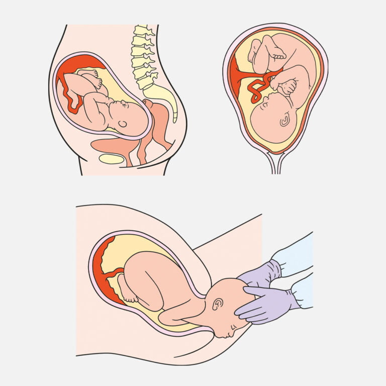 Birth illustrations for Baby Foundations worksheet
