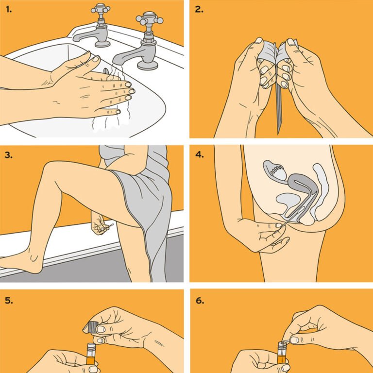 'How to' drawings for an instructional leaflet for King's College Hospital